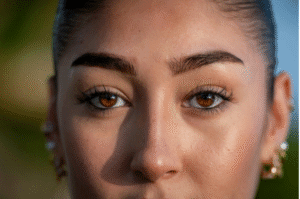 woman after blepharoplasty