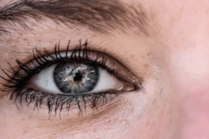 eye after blepharoplasty in Belgravia