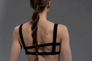 woman with moles on her back