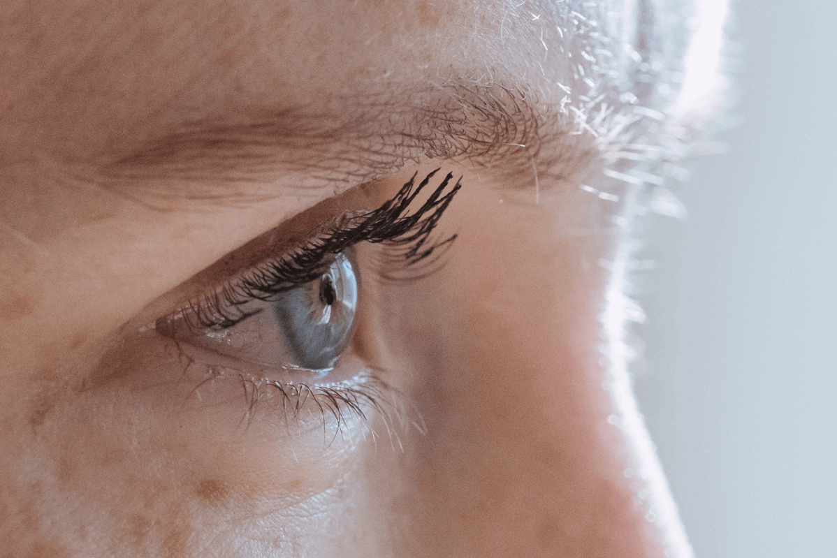 Womans eye after blepharoplasty surgery in Belgravia with Jonathan Dunnne